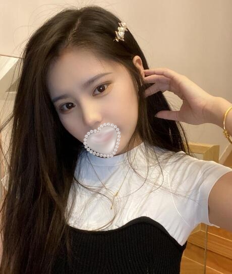 上海華美整形美容醫(yī)院隆鼻案例