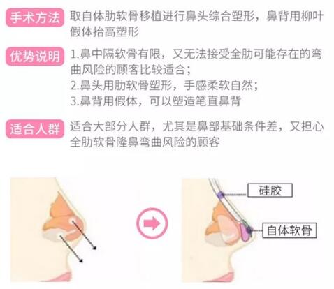姜平醫(yī)生科普隆鼻手術相關知識