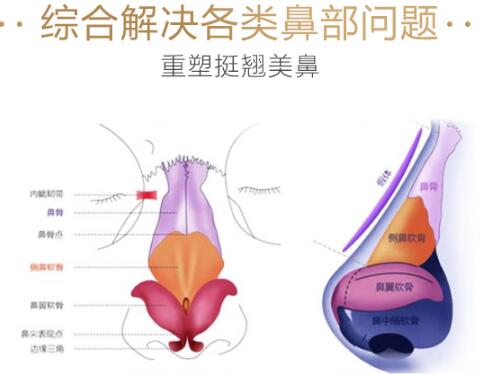 八大處謝洋春醫(yī)生科普鼻部手術