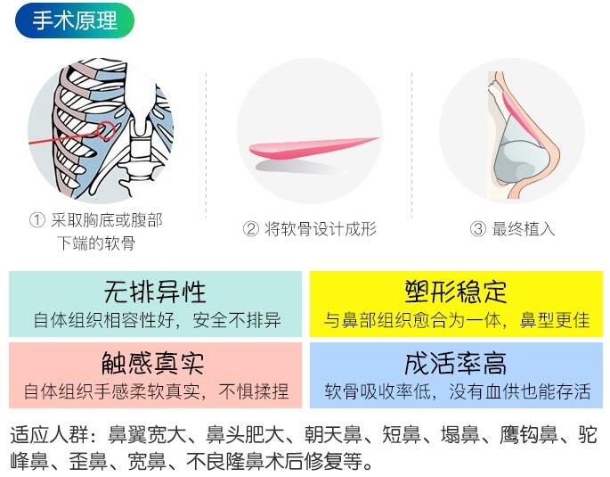 溫州美域高高志丹醫(yī)生科普隆鼻整形