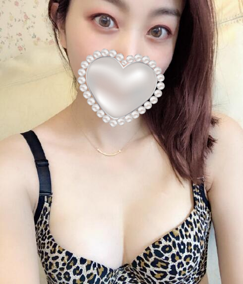 上海玫瑰醫(yī)療美容李鴻君隆胸案例分享