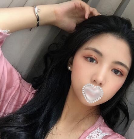 北京伊美爾做眼睛好嗎 案例分享