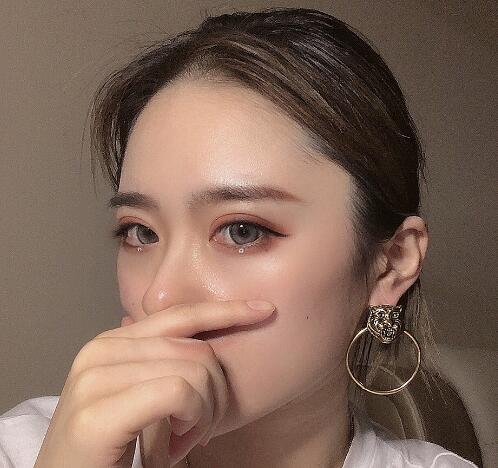 荊州中心醫(yī)院整形外科做雙眼皮案例