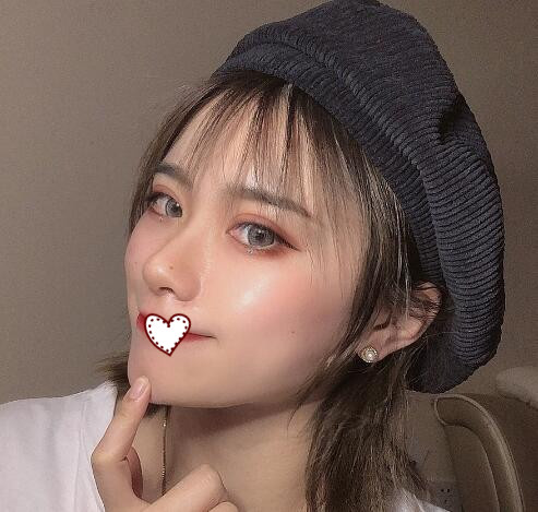 荊州中心醫(yī)院整形外科做雙眼皮案例