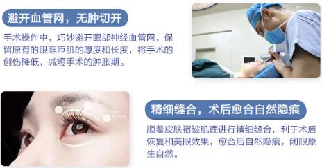 中山大學(xué)附屬第二醫(yī)院整形修復(fù)外科雙眼皮手術(shù)科普