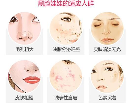 黑臉娃娃