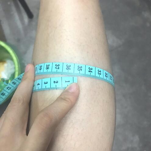注射瘦臉注射瘦腿術后果圖分享
