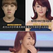 許譽恩Let美人蛻變過程分享，韓國超火的整形直播節(jié)目，驚呆了！