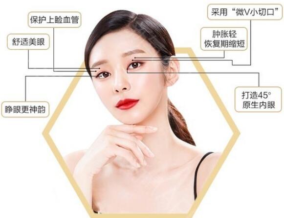 廈門美麗薇李國明醫(yī)生科普雙眼皮