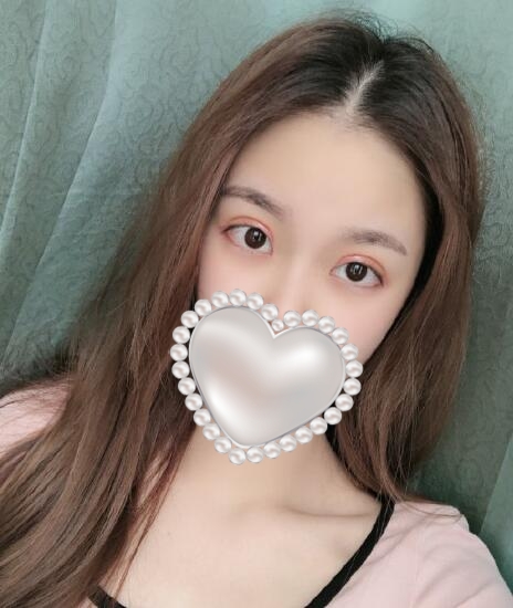 廈門美麗薇李國明醫(yī)生雙眼皮案例分享