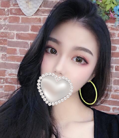 廈門美麗薇李國明醫(yī)生雙眼皮案例分享