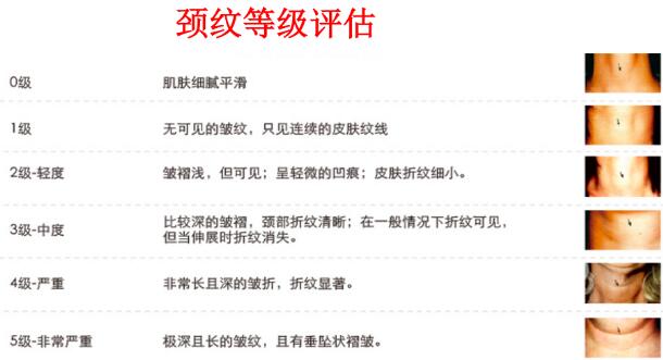 如何去除頸紋