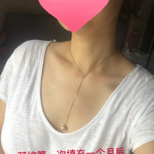 嗨體去頸紋