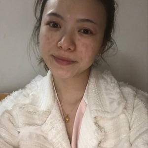 果酸換膚