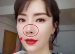 陳數(shù)有做過整容手術(shù)嗎？整容前后對比圖分享！