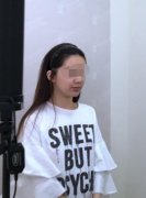 嘟嘟唇打完5天內(nèi)的圖片分享！來看術(shù)后果怎么樣吧