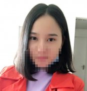 眼袋手術(shù)1--10天圖片曝光！做完確實(shí)年輕不少！來(lái)看案例