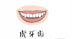 怎樣判斷虎牙和尖牙呢？拔掉老虎牙齒的更好時(shí)機(jī)是什么時(shí)間呢？