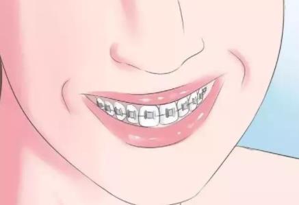 牙齒矯正