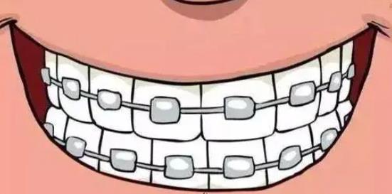 牙齒矯正