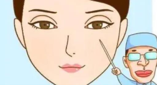 雙眼皮