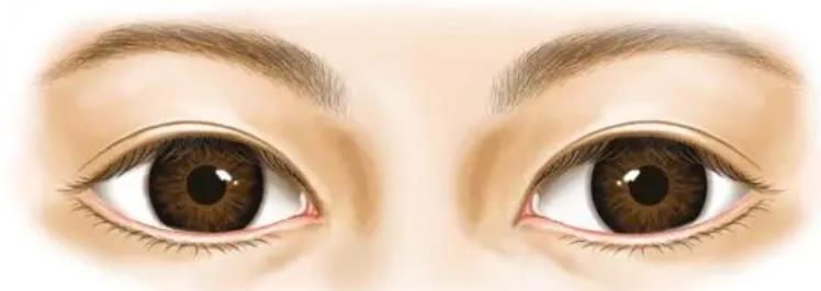 內(nèi)眼角