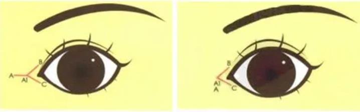 內(nèi)眼角