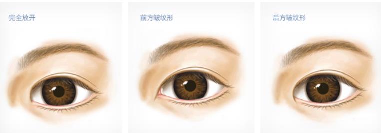 雙眼皮動(dòng)漫h22.jpg