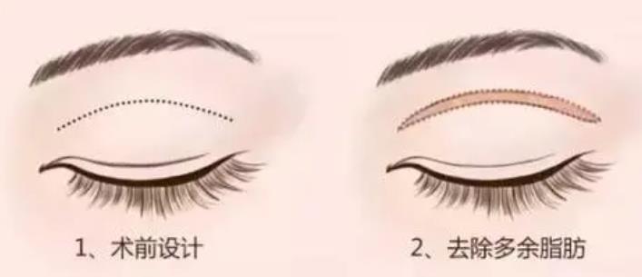 雙眼皮動漫h82.jpg