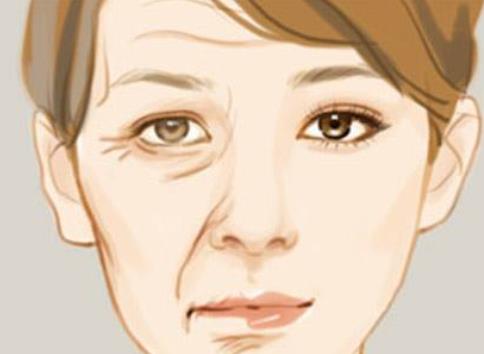 除皺動漫01.jpg