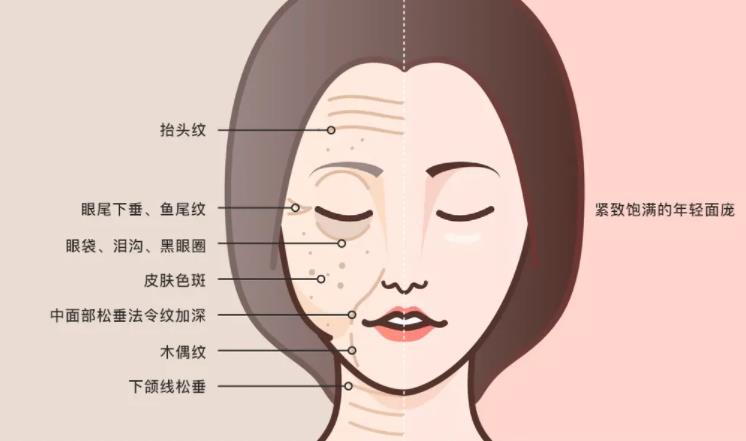 面部提升動(dòng)漫6.jpg