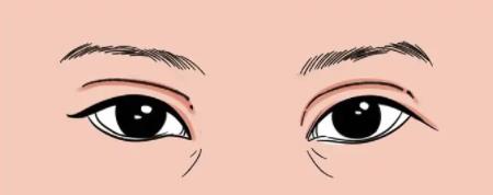 雙眼皮動漫h51.jpg