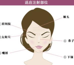注射除皺w1.jpg