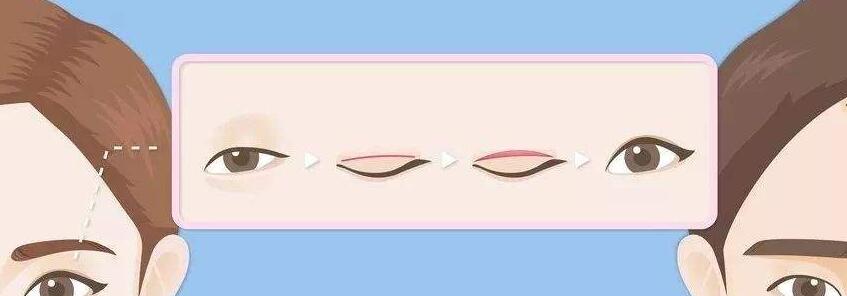 雙眼皮動漫32.jpg
