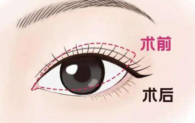 開(kāi)眼角動(dòng)漫05.jpg