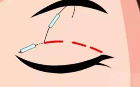 雙眼皮動漫64.jpg