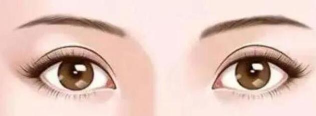 雙眼皮動漫30.jpg