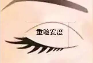 雙眼皮動(dòng)漫37.jpg