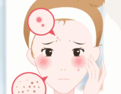 祛痘動(dòng)漫35.jpg