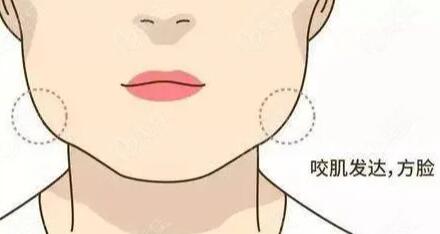 咬肌發(fā)達(dá)動漫01.jpg