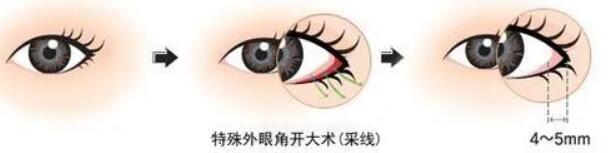 開外眼角動(dòng)漫04.jpg