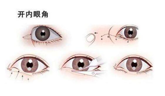 開(kāi)眼角動(dòng)漫06.jpg