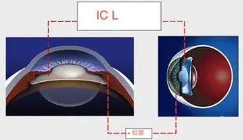 近視眼動漫15.jpg