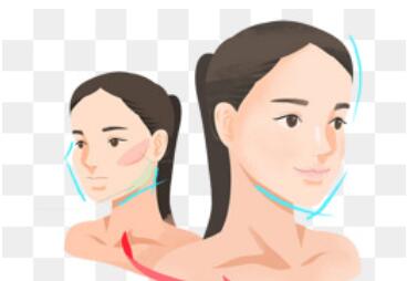下頜角動漫.jpg