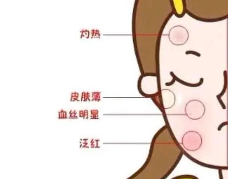 角質(zhì)層薄動(dòng)漫04.jpg