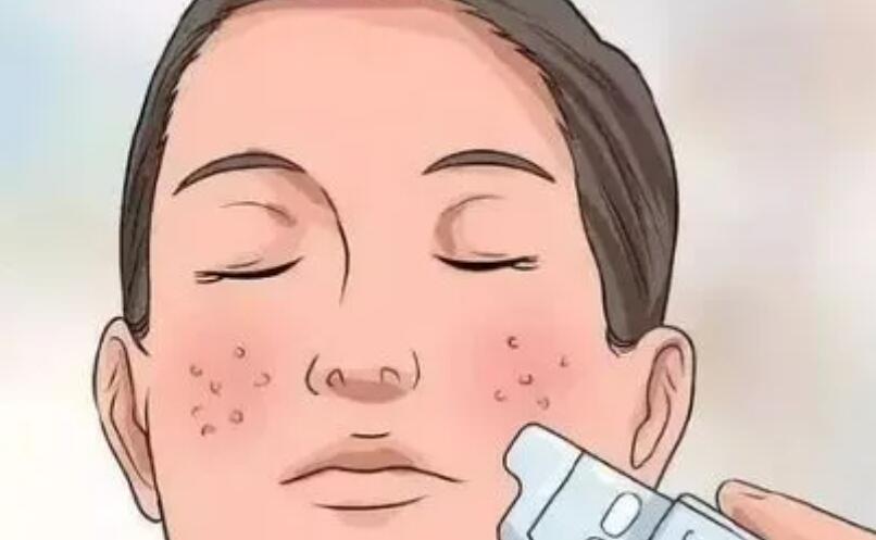 皮膚干燥粗糙怎么辦04.jpg