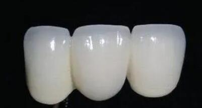 烤瓷牙動漫23.jpg