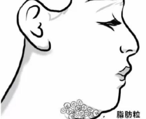 下頜角動(dòng)漫23.jpg