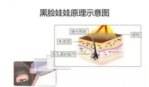 黑臉娃娃004.jpg