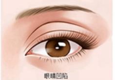 眼修復(fù)h4.jpg